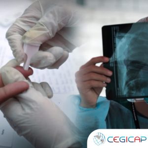 TBC Y COINFECCIÓN TBC - VIH