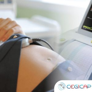 MONITOREO ELECTRÓNICO FETAL