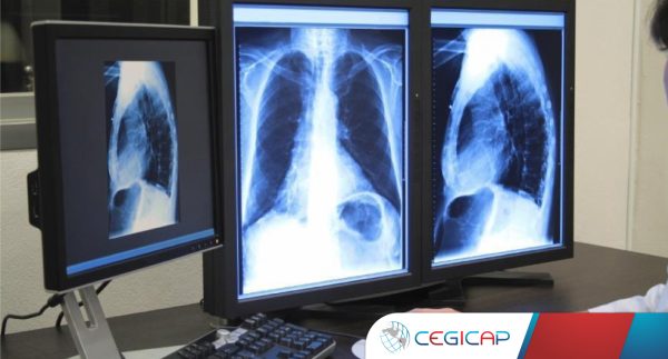 gestion-de-la-calidad-en-el-servicio-de-radiologia