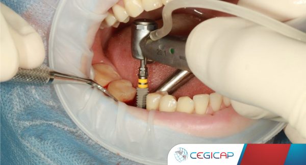 periodoncia-e-implantologia