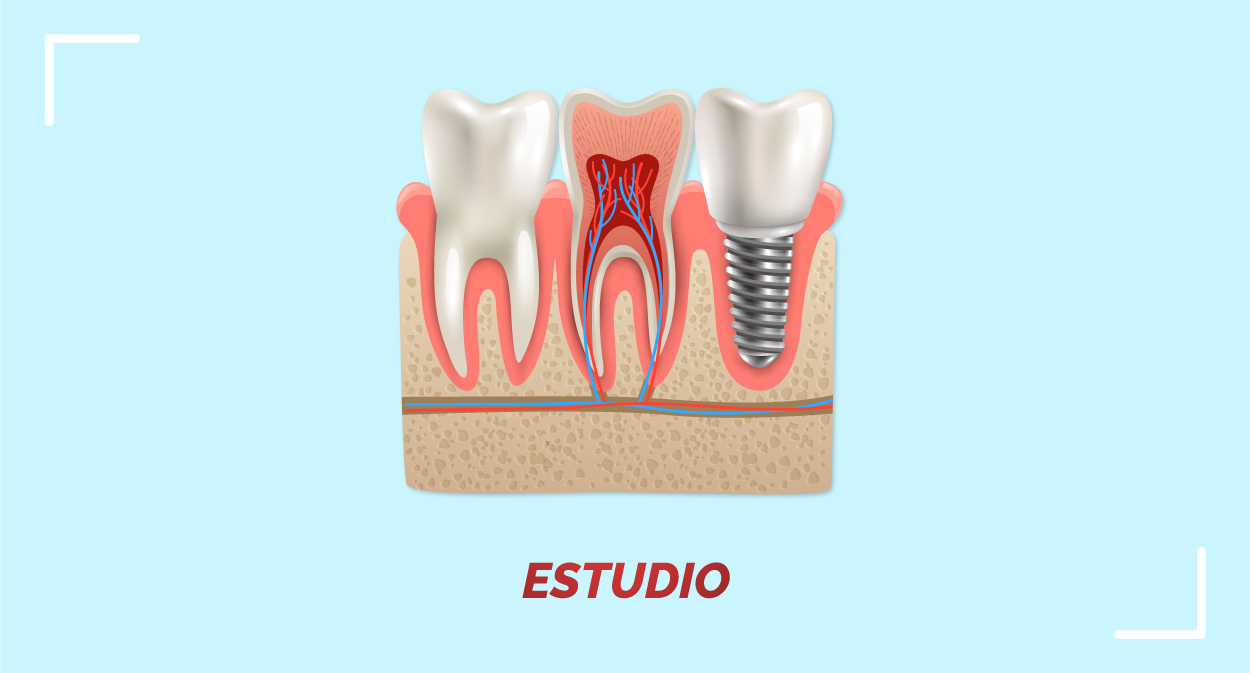 IMPLANTOLOGÍA ORAL - Imagen 2